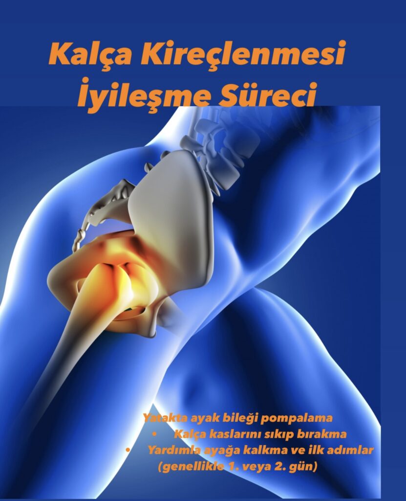 Kalça kireçlenmesi ve protez sonrası iyileşme süreciyle ilgili erken dönem fizik tedavi egzersizlerini gösteren medikal illüstrasyon