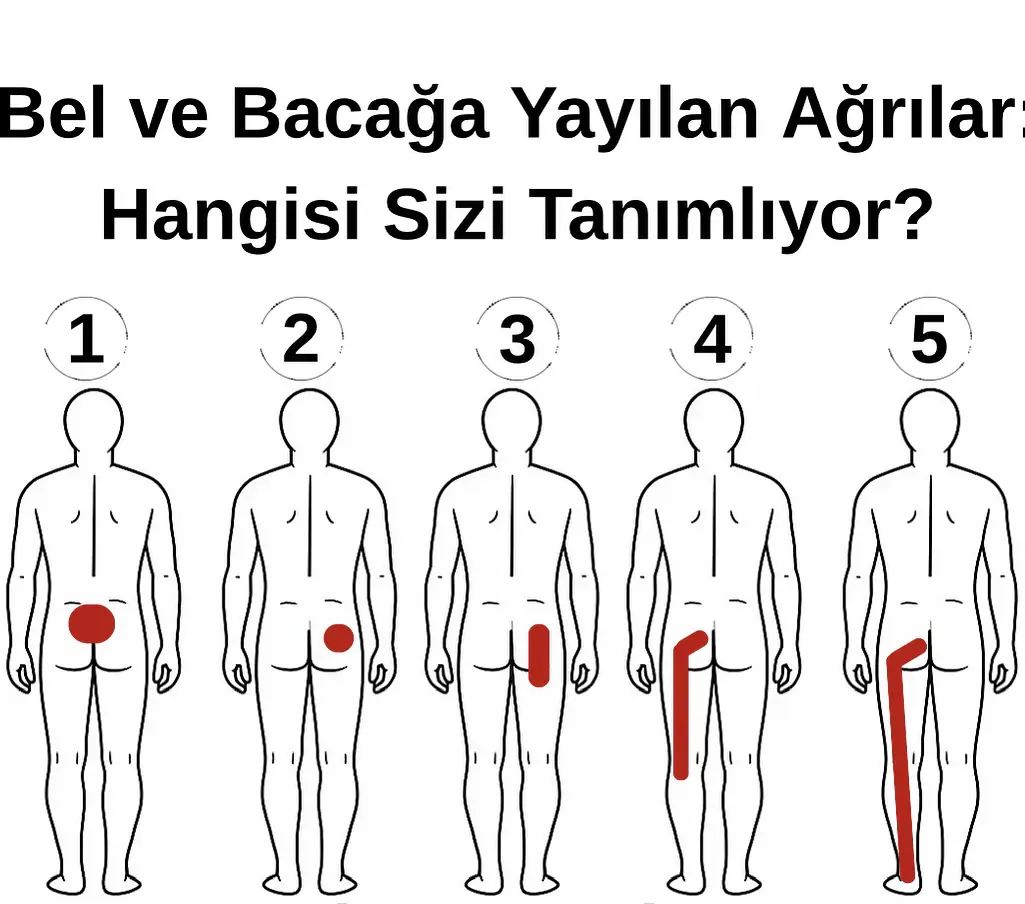 Bel Fıtığına Ne İyi Gelir? Fıtığa Ne İyi Gelir?