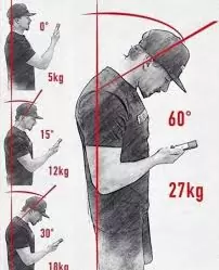 Boyun Düzleşmesi Tedavisi (Servikal Lordoz Azalması): Kanıta Dayalı Fizyoterapi Yaklaşımı