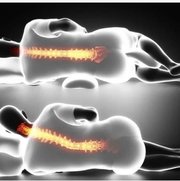 Yatak seçimi ağrılı hastalar için doğru Sertlikte seçim nasıl yapılır