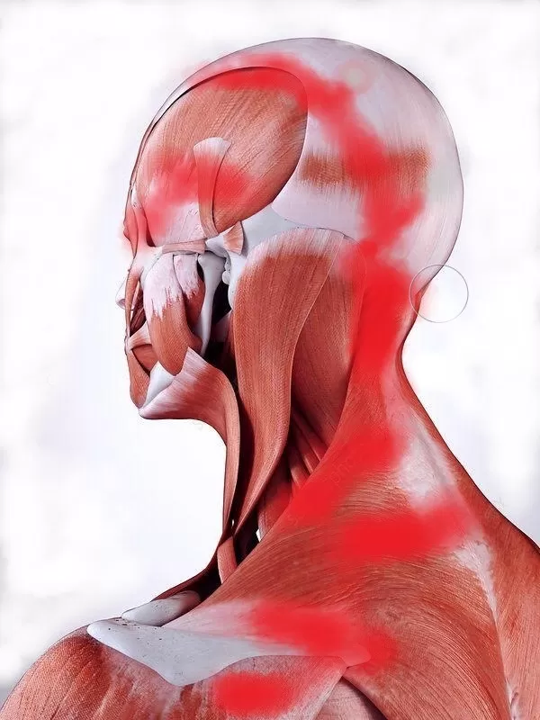 Boyun Ağrısı Nedenleri; Etkili Tedavi Yöntemleri