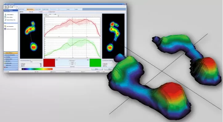 Ayak Analizi Ve Tabanlık